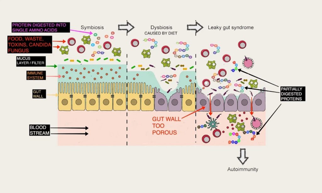 Diagram of the gut barrier and intestinal lining